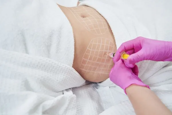 image of fat dissolving injections on love handles to help combat weight gain Eccleshill