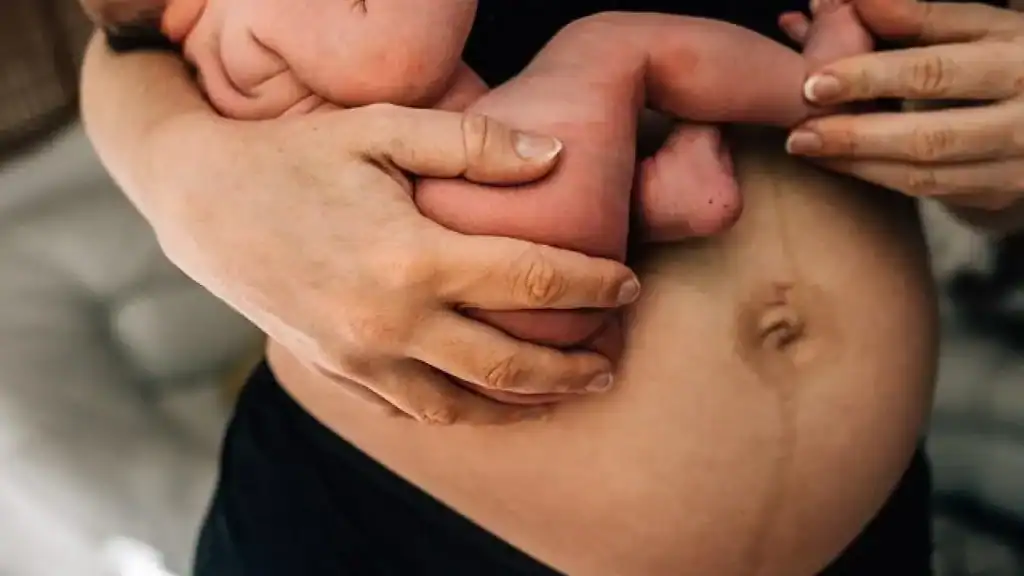 Why Is My Stomach Still Big After Pregnancy Eccleshill?